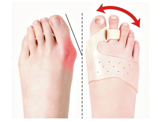 Toe separator for haluksy gel wedge magnet